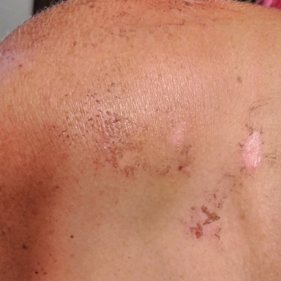 Update on Me!!🙏🛐 - Picture 6 of 7